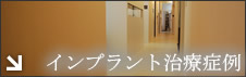 インプラント治療症例